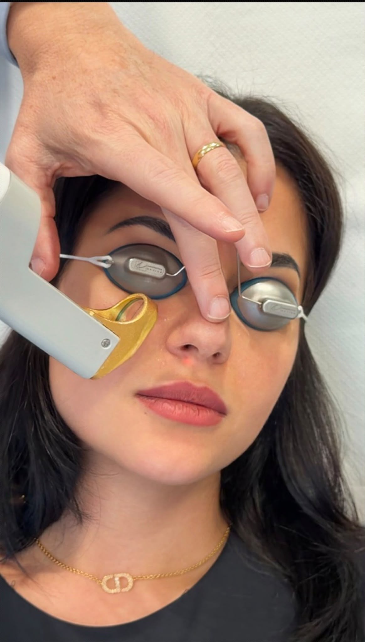 Traitement Laser Genesis réalisé sur une femme au Centre La Promenade à Sion