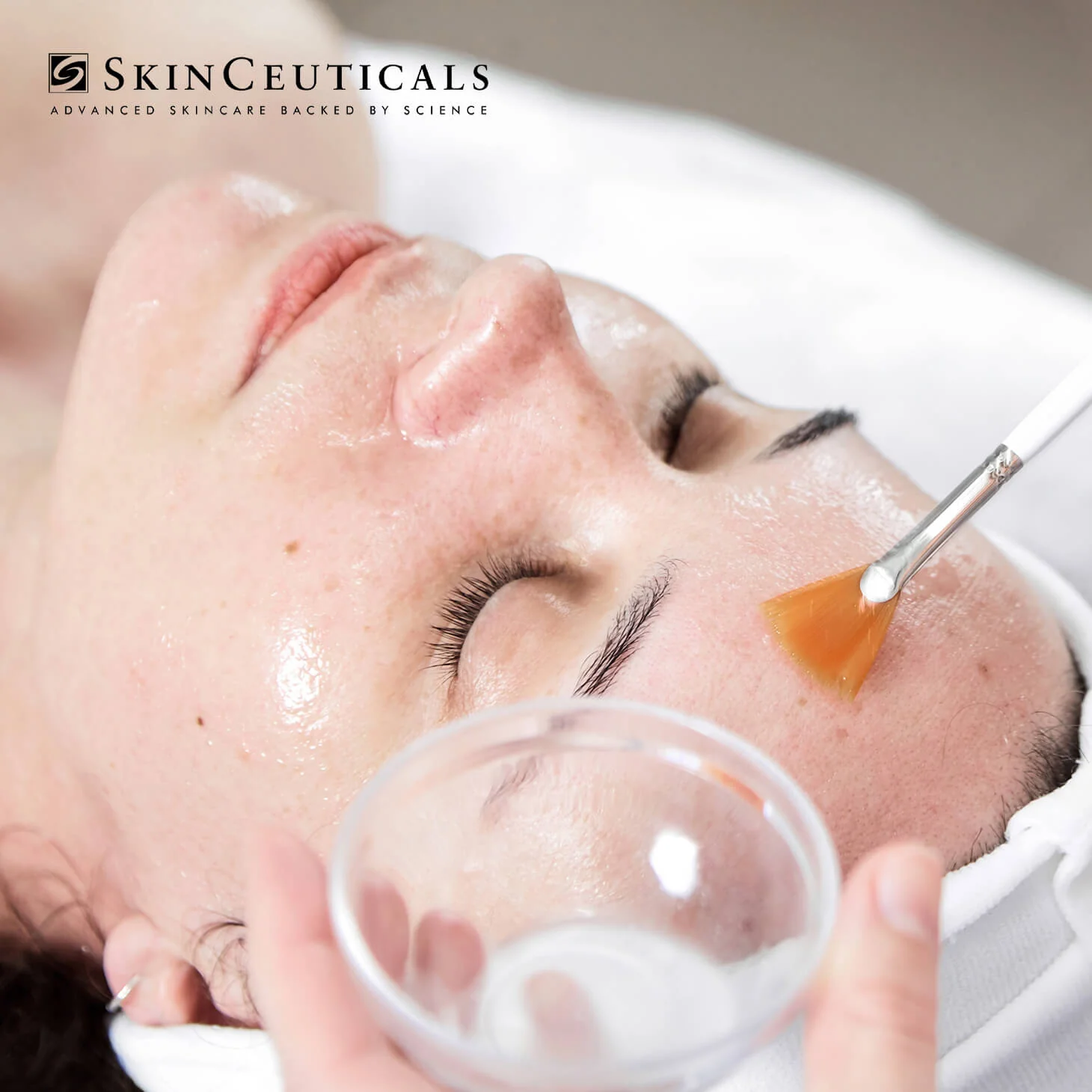Application d'un peeling SkinCeuticals aux acides de fruits